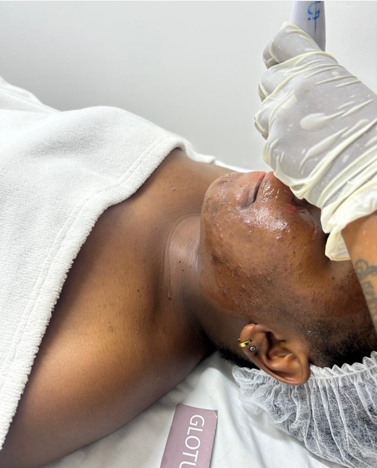 GLOTUCH Professional Treatment