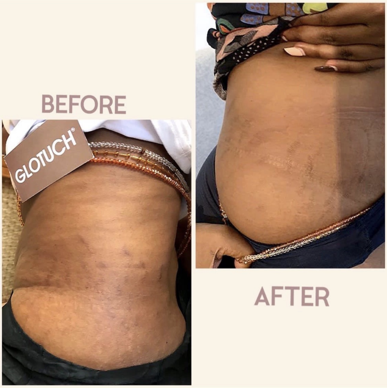 Body Treatment Results