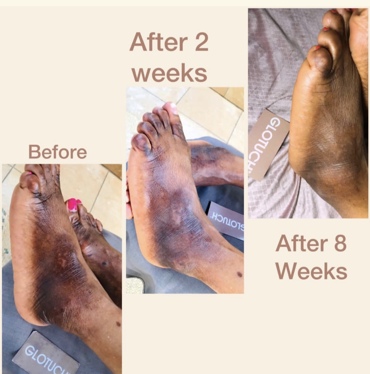 results.footProgression Results