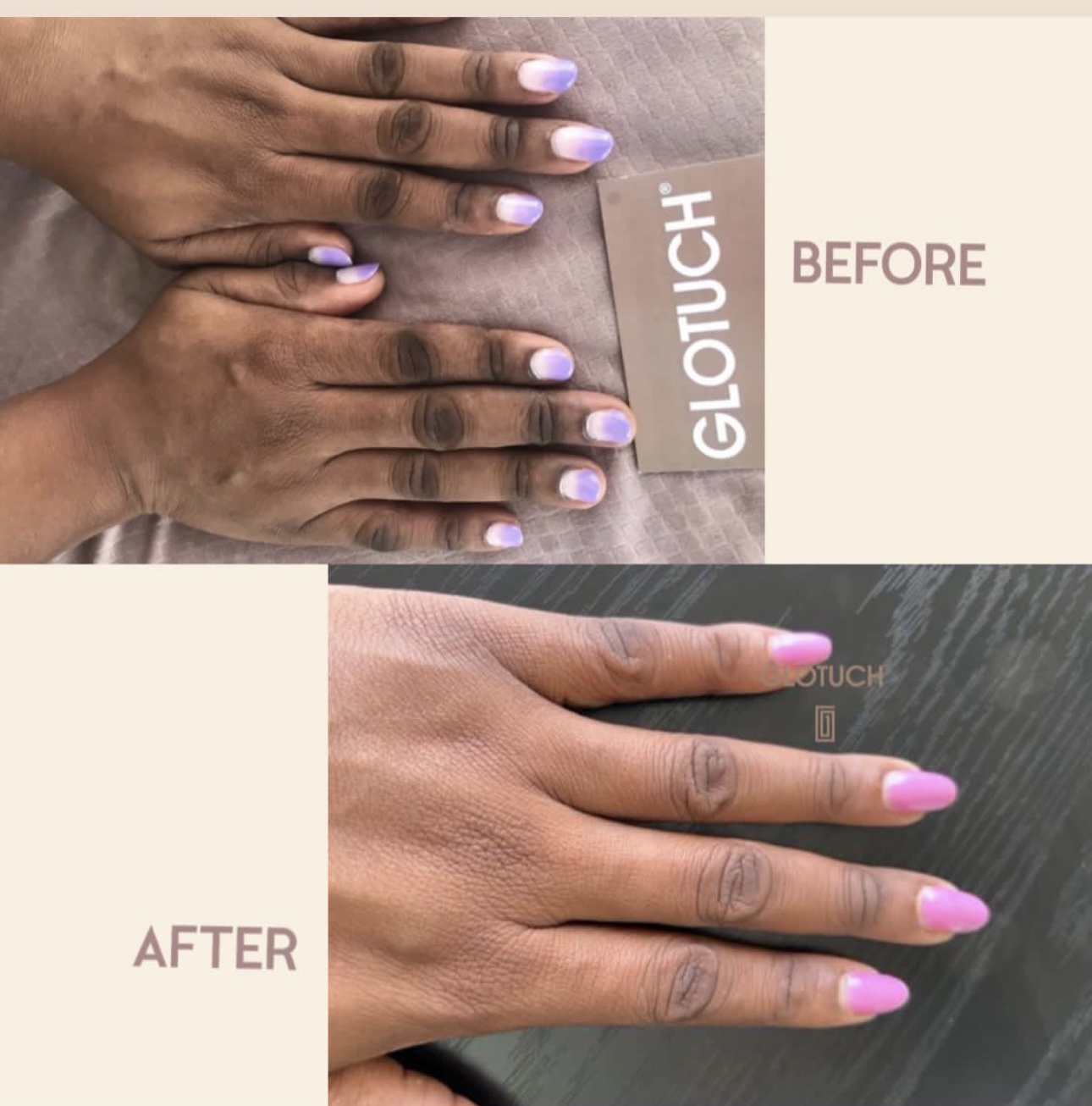 results.handTreatment Results